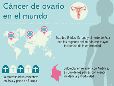 Ovarian cancer infographics