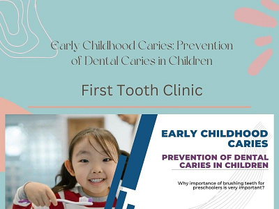 Prevention of Dental Caries in Children| Kids Dentist Near me-