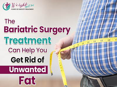 Best Obesity Surgery in Delhi best obesity surgery in delhi