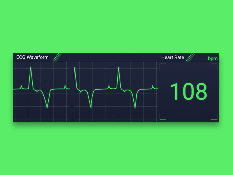 ECG Waveform Panel ecg gui heart rate monitor heart rate ui medical medical demo medical panel medical ui ui waveform