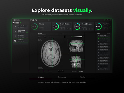 Explore datasets visually. artificial intelligence machine learning medical ui design web design