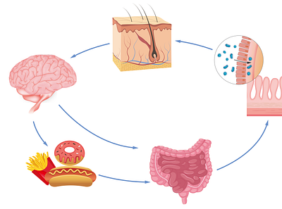 Popular science illustration - Food causes skin problems