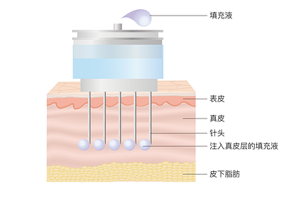 illustration about water light needle