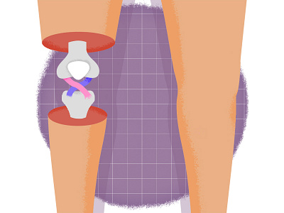 ACL acl anatomy bone knee leg texture