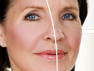 Wrinkle skin texture wrinkle