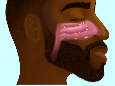 Nasal Polyps Illustration digital painting illustration medical realism