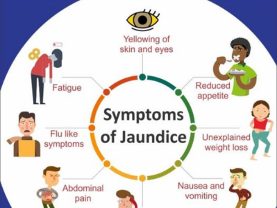 What Is Jaundice Causes Symptoms And Treatment Medlifeweb