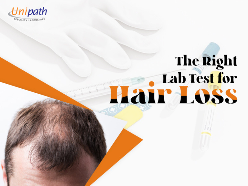 How To Choose The Right Lab For Blood Test For Hair Loss? by unipath
