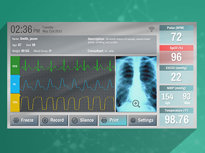 Patient Vital Signs Monitor UI Concept
