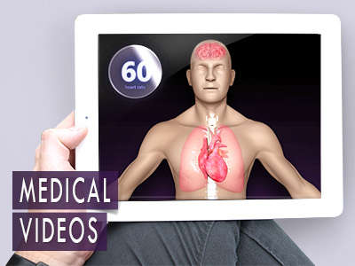 medical videos for presentations!