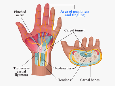 Buoy Health Pinched Nerve Article Illustrations article body health health app healthcare illustrations nerve vertebra