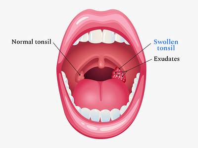 Buoy Health Strep Throat Article Illustration body disease editorial health health app illustration organs