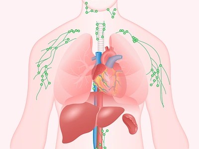 Lymphoma Medical Illustration application body disease gradient health healthcare heart help human illustration light liver lungs man people