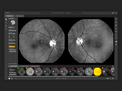 Medical Application application dark dark ui desktop app eyes health healthcare healthtech medical medical app optometry user flows
