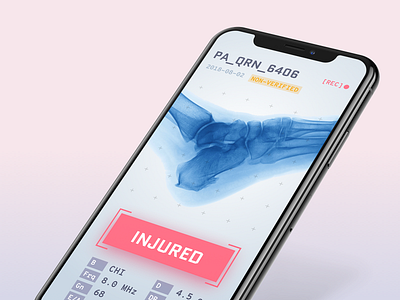 X-Ray App ai body bones injury iphone learning machine medical ui ux x xray
