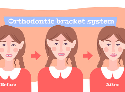 Braces on teeth flowchart composition braces correction flat illustration patient teeth vector