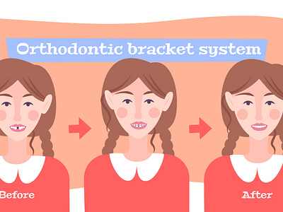 Braces on teeth flowchart composition