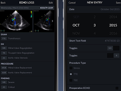 ECHO Logs App app cardiography echo echo logs echocardiography health ios logs ui ux