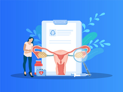 Endometriosis vector illustration. growth
