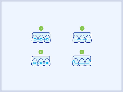 Types of braces icons braces dental dental icons icon icons medical illustration orthodontist