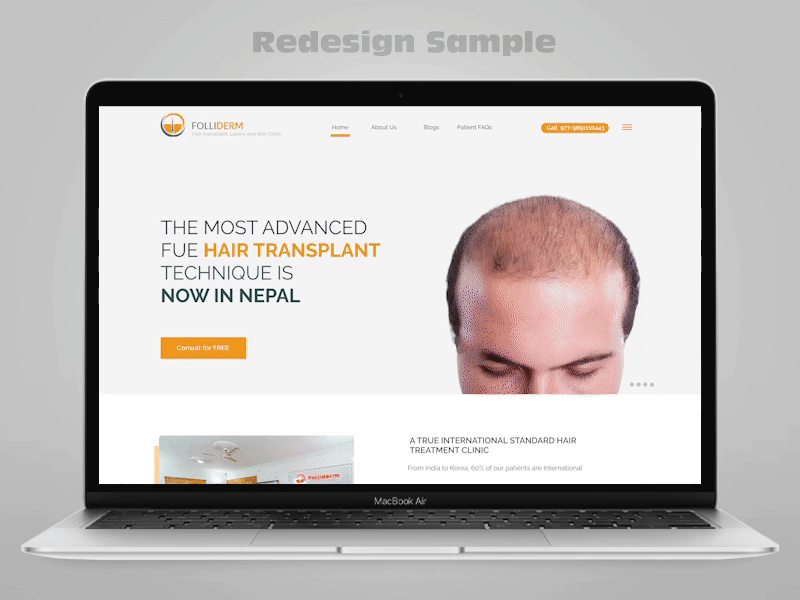 Folliderm design landing page layout redesign rokaya ui design web website