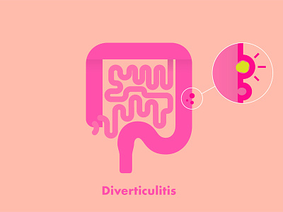 Guts design diverticulitis illustration medical