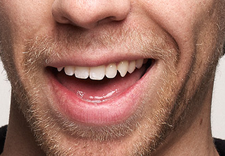 Mounds of retouching face mouth person portrait