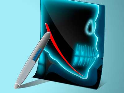 Iconos Medicina Dental (draw nerve)