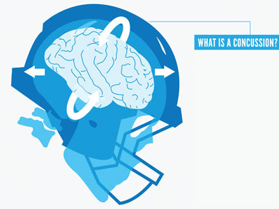 Concussion Infographic concussion football illustration infographic nfl