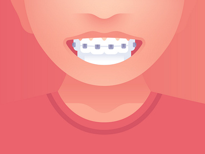 Remember to Smile braces characters dental dentist design flat happy illustration joy patient revenuewell smile teeth