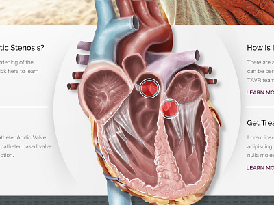 Heart Valve website redesign health healthcare landing page medical one page responsive web