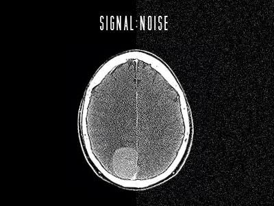 signal:noise