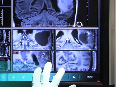 YScope 3d kinect medical mri touchless ui usability user interface ux