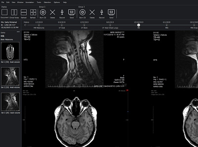 UI/UX for Radiology Imaging Viewer using Qt Design Studio healthcare imaging medical radiology ui ux viewer