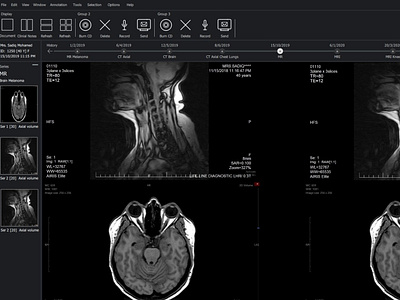 UI/UX for Radiology Imaging Viewer using Qt Design Studio