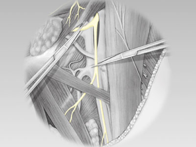 Surgery anatomy gray illustration medical surgery