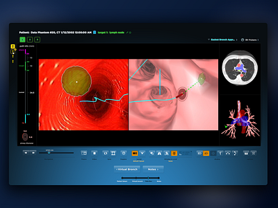 Bronchoscopic Surgical Navigation UI - Path Navigation