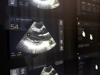 Ultrasound app dark layout map ultrasound wireframe