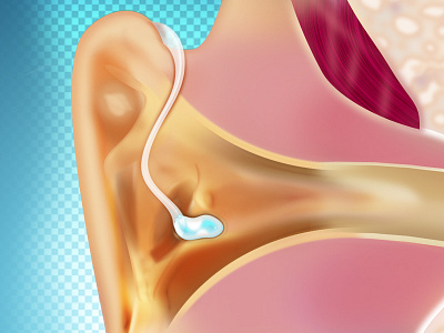 Hearing aid hearing aid illustration medical