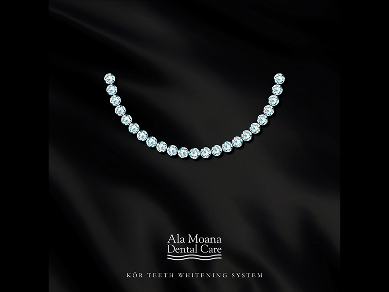 Diamonds writer bradley shin luxury white and black clean honolulu wasiswas hawaii dental dentist whiten white jewels diamonds