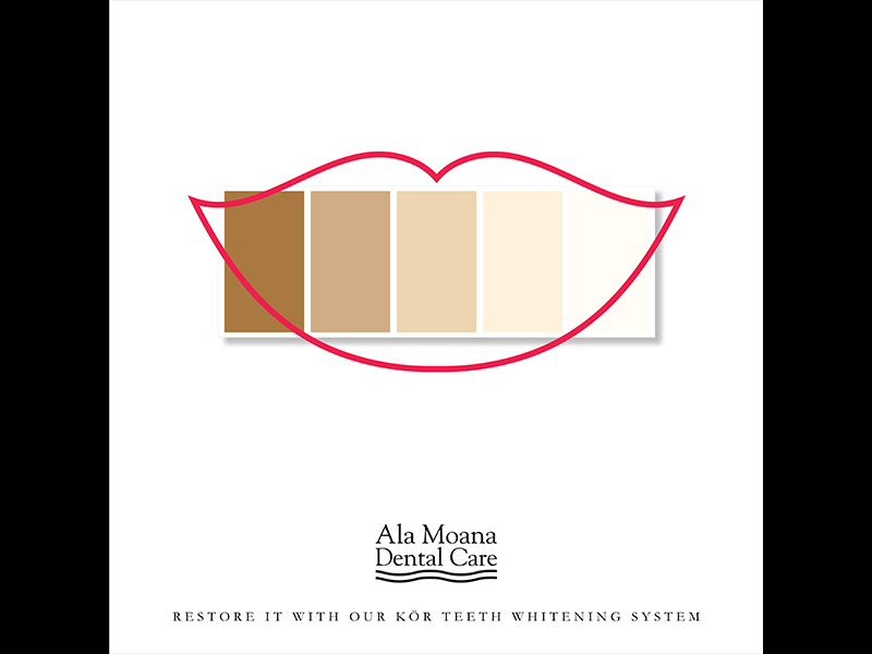 Tan instagram smile white restore writer wasiswas honolulu whitening dental teeth hawaii