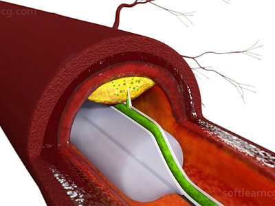 Micro needle treatment 3d medical animation 3d animation 3d model illustration medical product animation softlearncg