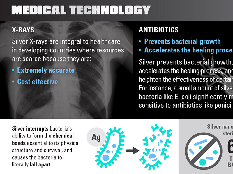 infographic infographic silver icon xray