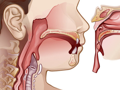 Illustration for Cornell Otorhinolaryngology