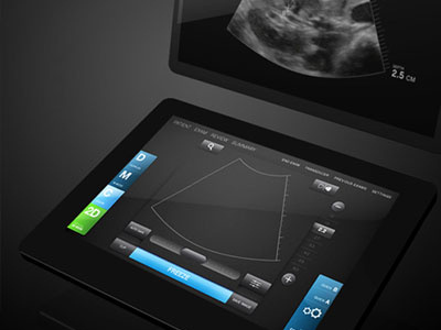 SonoSite X-porte artefact healthcare medical touch ui ui ultrasound xaml