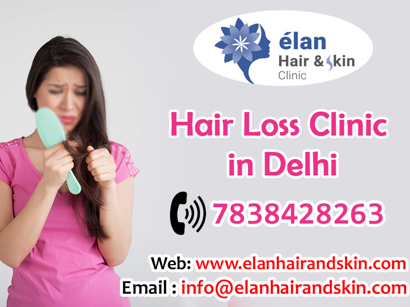 Best Hair Transplant And Skin Care Clinic In Delhi By Elen Clinic On Dribbble