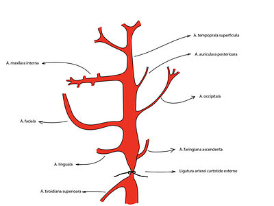 Carotid artery