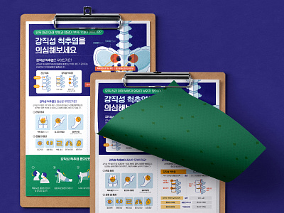 [Infographic] Ankylosing spondylitis Poster