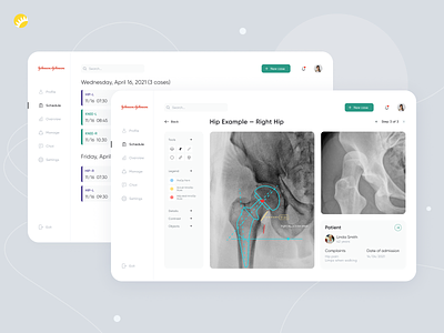 Medical imaging software app design assistance design easy to use health healthcare high quality high resolution imaging intuitive medical mobile app operations performance software surgery tracking ui ui design ux