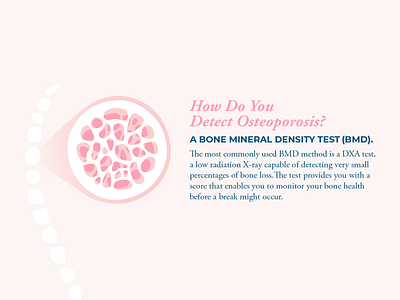 Osteoporosis Infographic Section